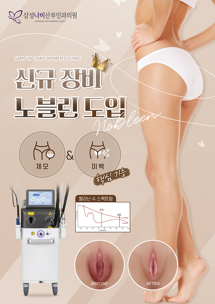 신규장비 노블린 도입